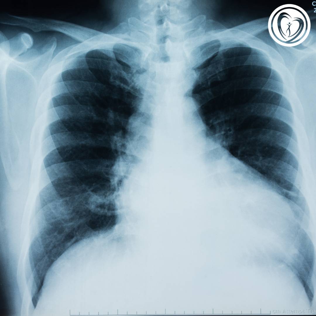 pneumologista curitiba - endocore